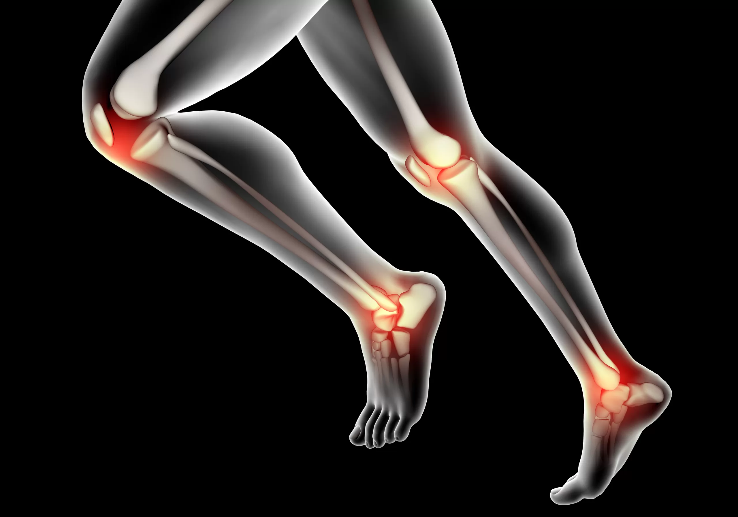 Traumatologia do Esporte